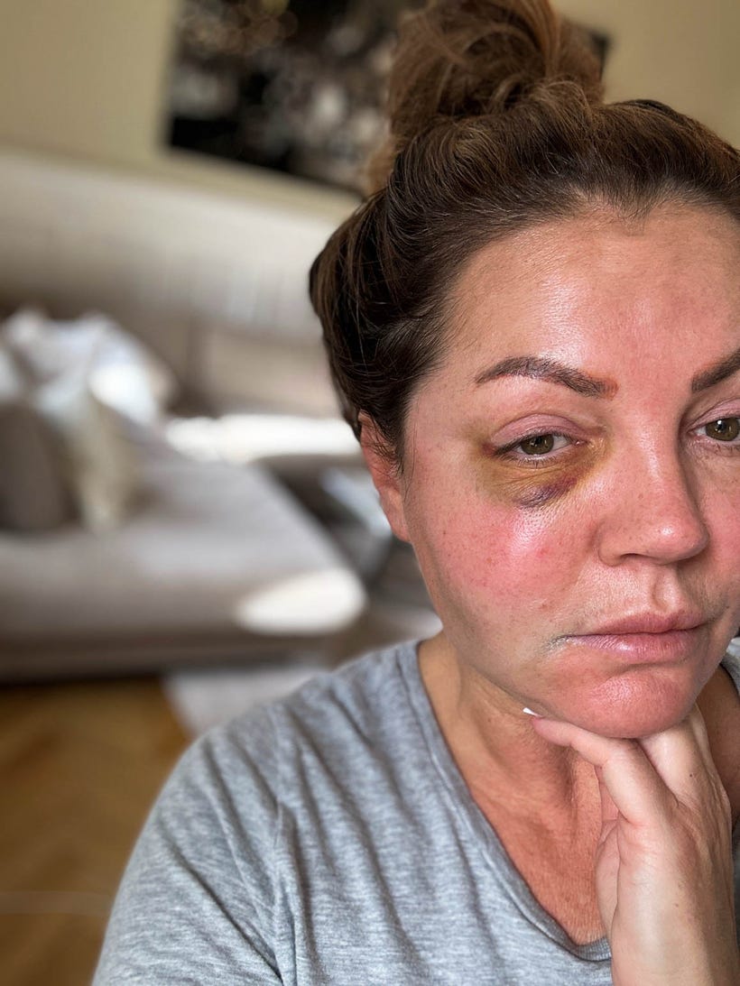 Tongiz bilan jinsiy aloqa onlayn